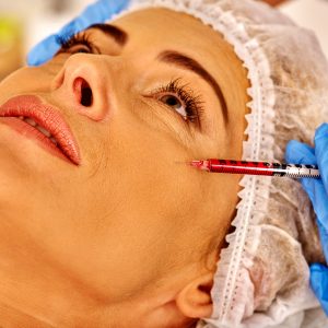 smile beauty botox