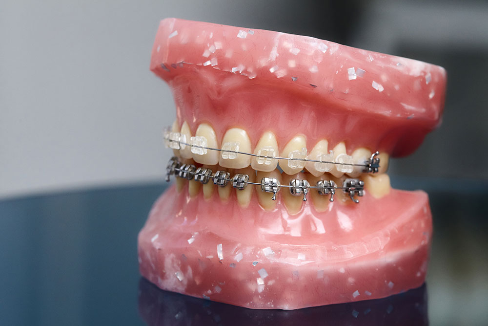 teeth health dentist smile