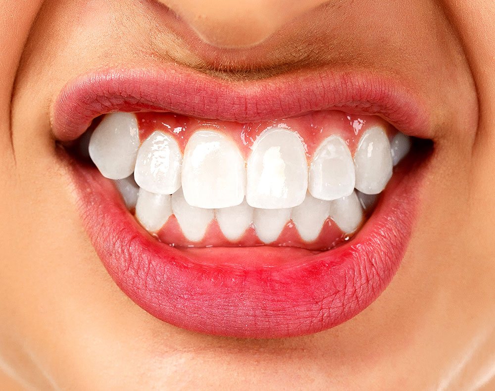 smile teeth beauty dentist