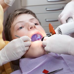 smile teeth beauty