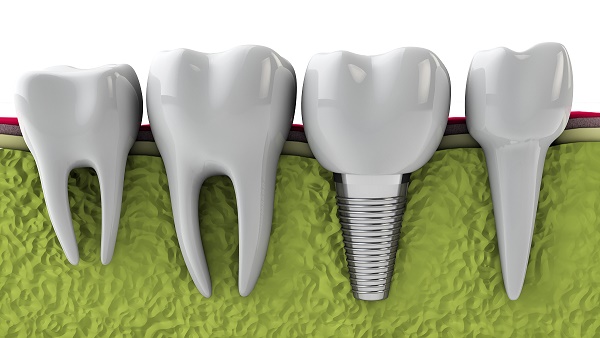 Chessington Dental Practice Blog