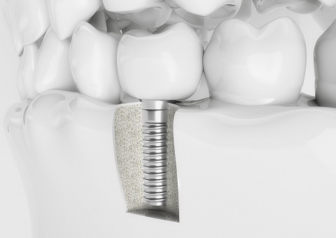 Chessington Dental Practice Blog