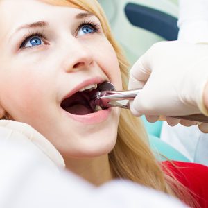 smile teeth beauty